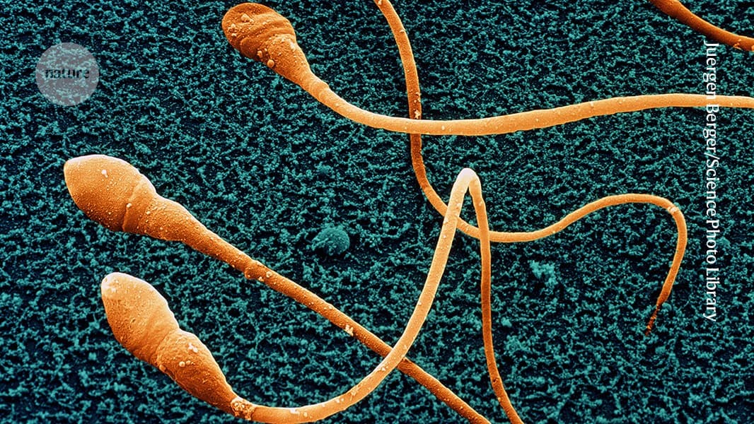 Lab-grown sperm: scientists inch closer to fertility breakthrough