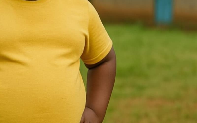 Explainer: How genetics shapes obesity and why environment still matters