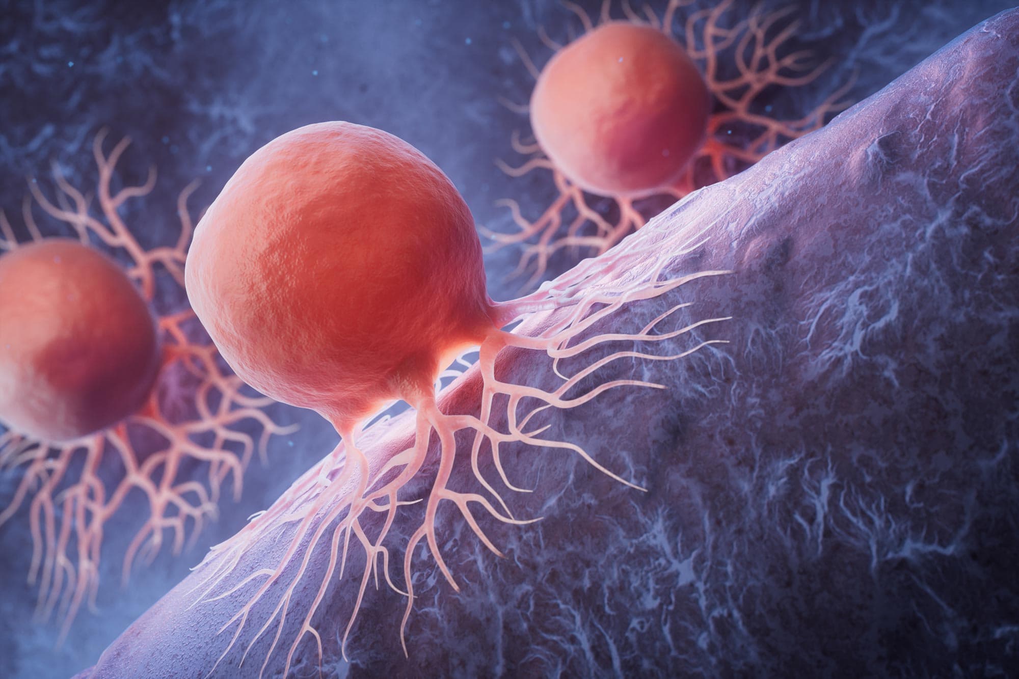 Global Cancer Cases Could Surge 67% by 2050, New Report Warns