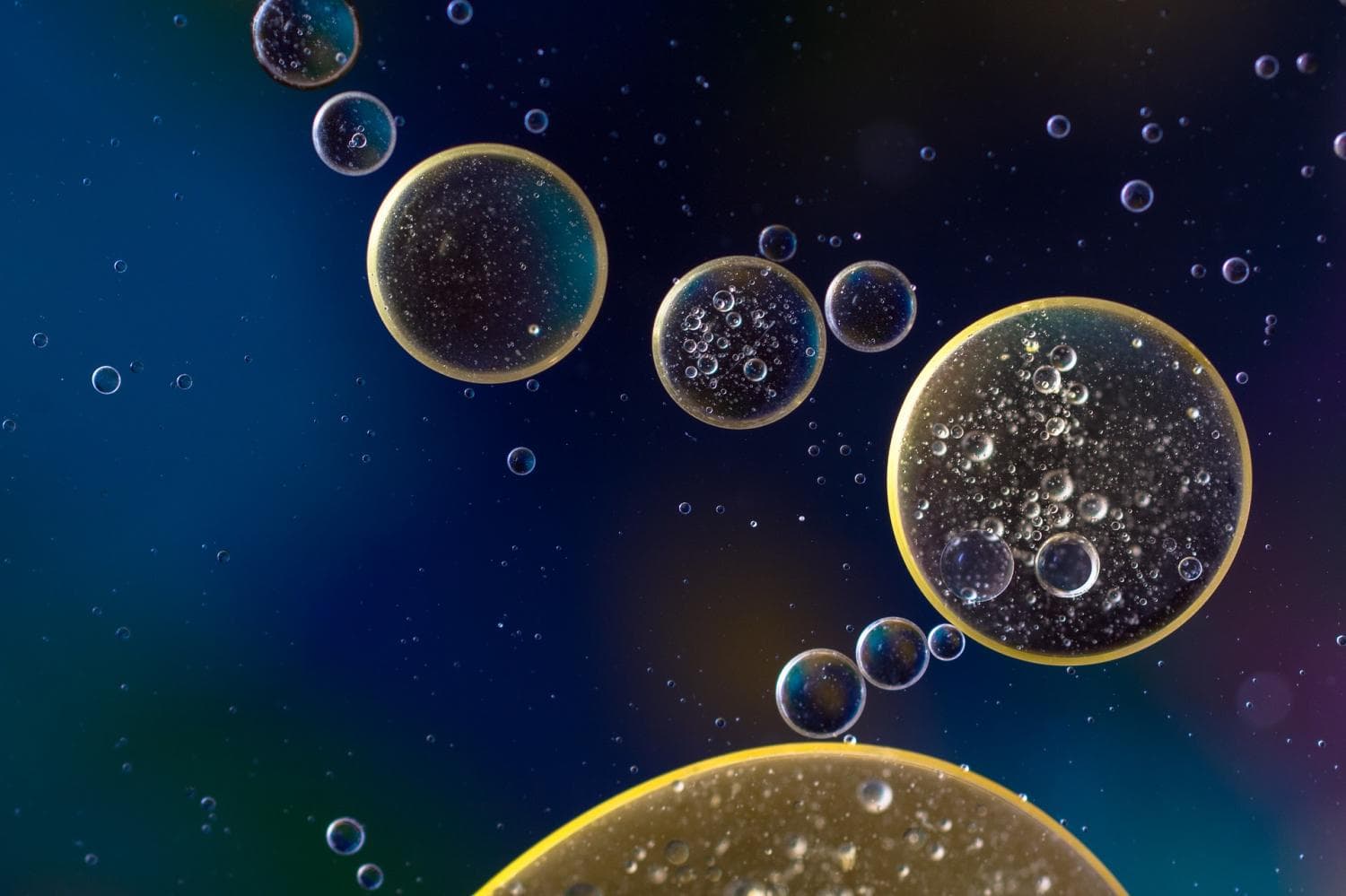 Aging rewires RNA production, favoring short genes over long neuronal ones