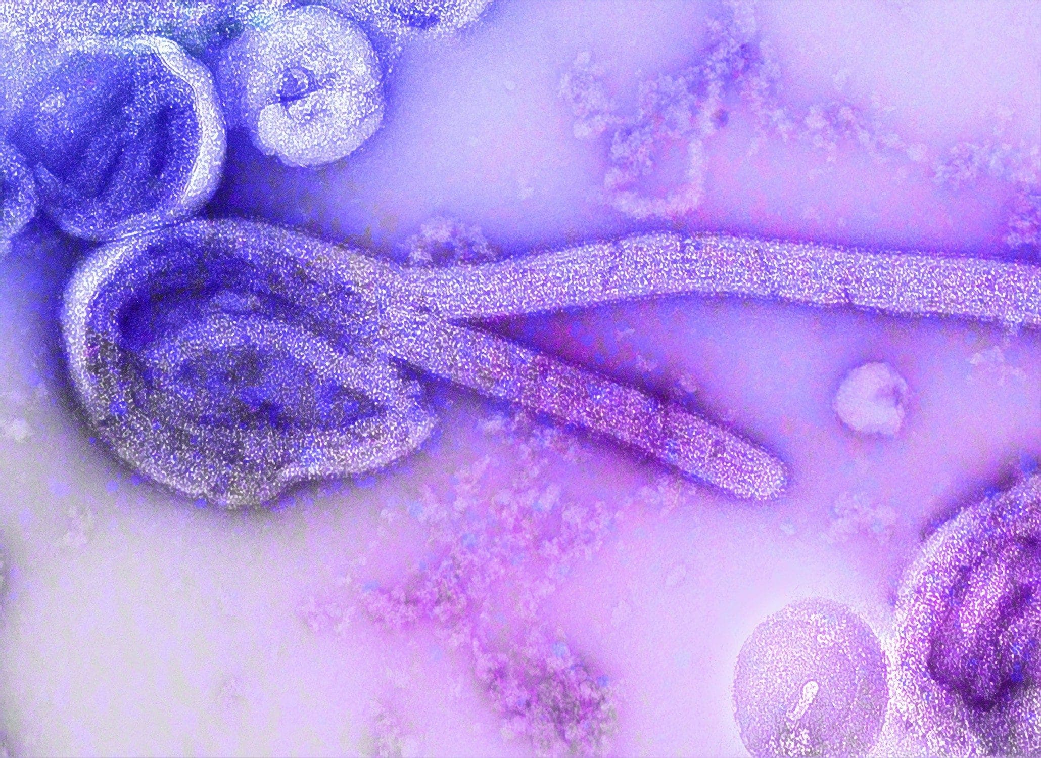 Liverpool School of Tropical Medicine: Researchers call for increased screening for parasitic disease linked to HIV and cervical cancer risk