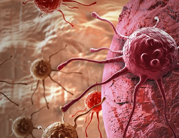 New approach enhances radiotherapy by disabling cancer's DNA repair machinery