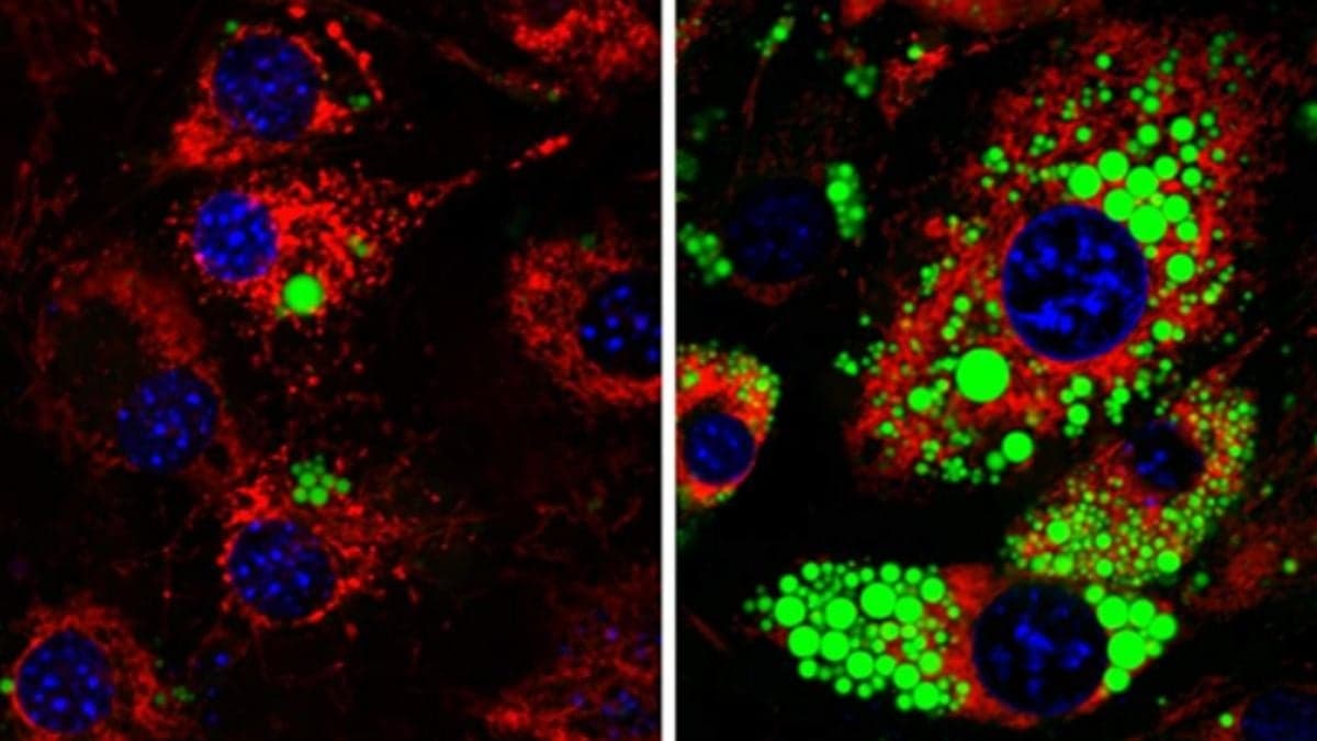 Crucial Fat Metabolism Switch Identified in Human Cells For First Time